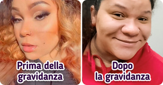 “2 persone diverse”: il naso di questa 24enne è cambiato così tanto durante la gravidanza da non essere più riconoscibile