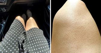 9 caratteristiche fisiche delle donne che sono considerate difetti senza motivo