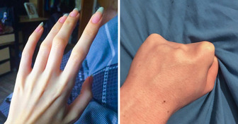 13 persone ci mostrano le loro “caratteristiche speciali”