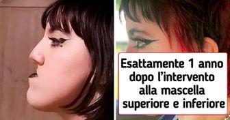 18 persone che hanno osato sottoporsi a un intervento di chirurgia plastica e hanno fatto tombola