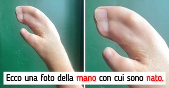 15 persone con tratti fisici fuori dall’ordinario che le fanno distinguere tra la folla