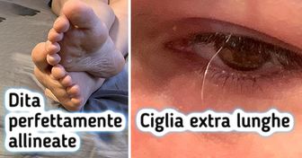 16 persone i cui corpi sono delle vere sorprese