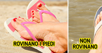 9 piccoli trucchi che renderanno finalmente più comode le tue scarpe