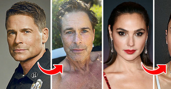 14 celebrità che non hanno avuto paura di condividere foto senza filtri