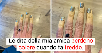 15 persone che sembrano vivere nel paese delle meraviglie, perché hanno trovato qualcosa di insolito