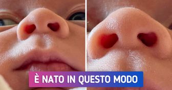 16 volte in cui Madre Natura è stata creativa e ha donato dei tratti davvero unici
