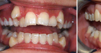 16 persone le cui trasformazioni ci hanno lasciati a bocca aperta