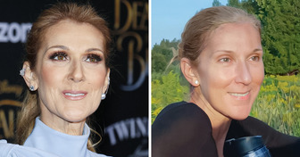 14 celebrità che hanno condiviso foto senza trucco, lasciando i loro fan a bocca aperta