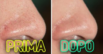 10 dritte di dermatologi che possono aiutarti a restringere i pori