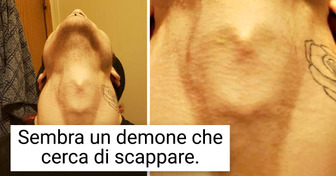 17 persone il cui corpo è pieno di tesori meravigliosi