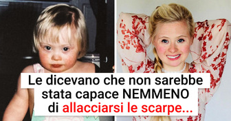 La storia di Grace: ha ottenuto l’impossibile, provando che si può sfidare il proprio destino