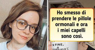 18 persone che hanno smesso di modificare i capelli e si sono godute i risultati