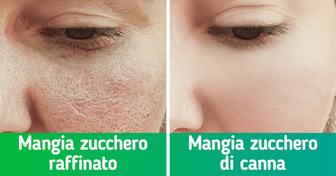 5 consigli degli esperti per restringere i pori