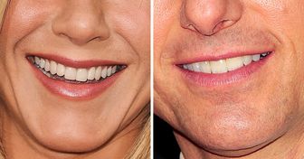 Test: riesci a riconoscere le celebrità semplicemente dai loro sorrisi?