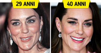 16 foto ravvicinate dei reali: come sono cambiati nel corso degli anni