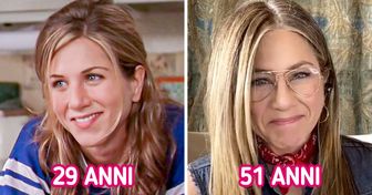 11 celebrità che hanno evitato la chirurgia plastica e hanno accettato il loro aspetto naturale