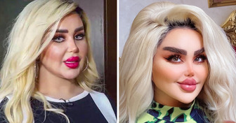 Ho fatto 43 interventi estetici per assomigliare a una Barbie, ma i critici dicono che assomiglio a uno “zombie”