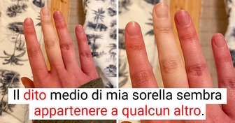 17 volte la natura ci ha preparato delle curiose sorprese