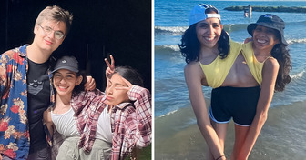 Due gemelle siamesi spiegano come una ha trovato l’amore da 2 anni mentre l’altra è asessuale