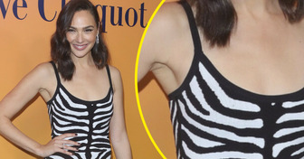 17 donne famose che se ne fregano degli standard di bellezza