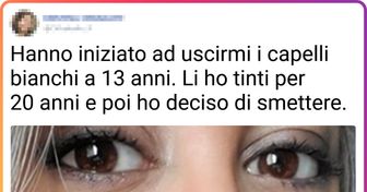 17 donne che hanno deciso di non seguire gli standard di bellezza e hanno accettato i loro capelli bianchi