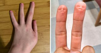 13 rare caratteristiche del corpo che rendono speciali chi le possiede