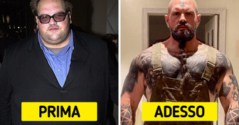 Come 10 celebrità sono cambiate nel tempo dopo essere diventate famose