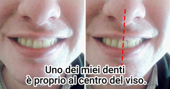 15+ caratteristiche veramente rare che alcune persone possiedono