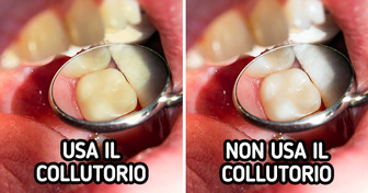 7 abitudini quotidiane che macchiano i denti