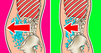 Come ridurre il gonfiore