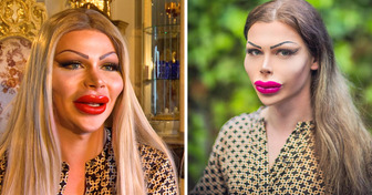 Ho speso 67000 euro per un intervento chirurgico e non intendo fermarmi