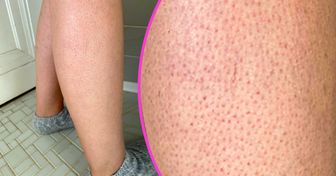 12 caratteristiche del corpo che vediamo come difetti, ma non lo sono