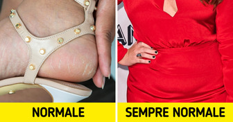 16 cose normali per cui le donne non dovrebbero sentirsi insicure