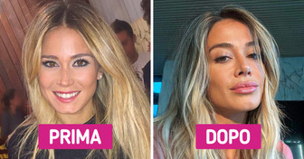 Diletta Leotta e altre 20 celebrità hanno rivelato di essere ricorse alla chirurgia plastica e di non pentirsene