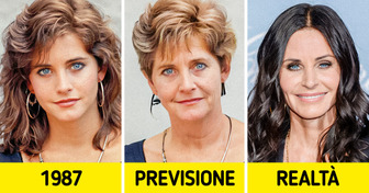 Come sarebbero 10 celebrità senza i moderni trattamenti di bellezza