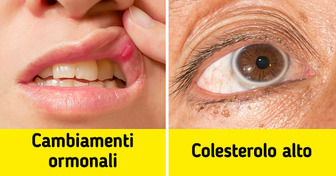 8 segnali d’avvertimento da parte del tuo corpo che non dovresti ignorare