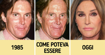 Come sarebbero state 8 celebrità se non si fossero mai sottoposte a interventi estetici