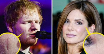 7 celebrità che accettano le loro caratteristiche uniche