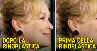 Che aspetto avrebbero le celebrità se si fossero sottoposte alle procedure cosmetiche