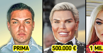 Ho speso 1 milione di euro in chirurgia plastica per assomigliare a una bambola Barbie