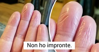 17 persone che hanno scoperto qualcosa di unico nel loro corpo