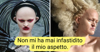 Melanie Gaydos: una modella con condizioni genetiche rare che ha infranto tutti gli stereotipi della moda