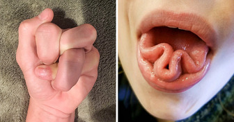 18 foto che dimostrano che il corpo umano è pieno di sorprese