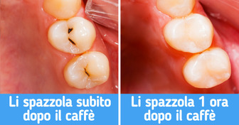 7 consigli per rendere i tuoi denti bianchi e sani