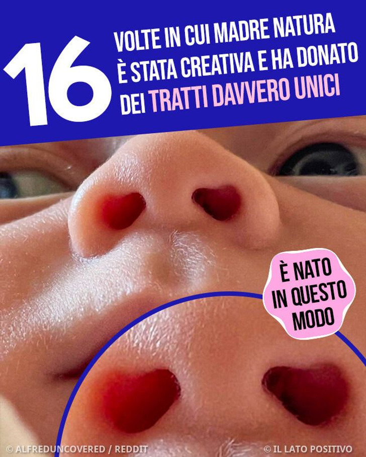 16 volte in cui Madre Natura è stata creativa e ha donato dei tratti davvero unici