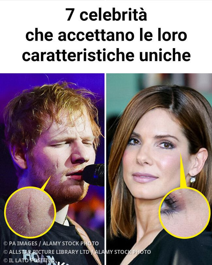 7 celebrità che accettano le loro caratteristiche uniche