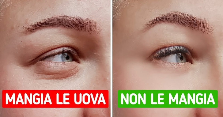 Che cosa succede se smetti del tutto di mangiare le uova