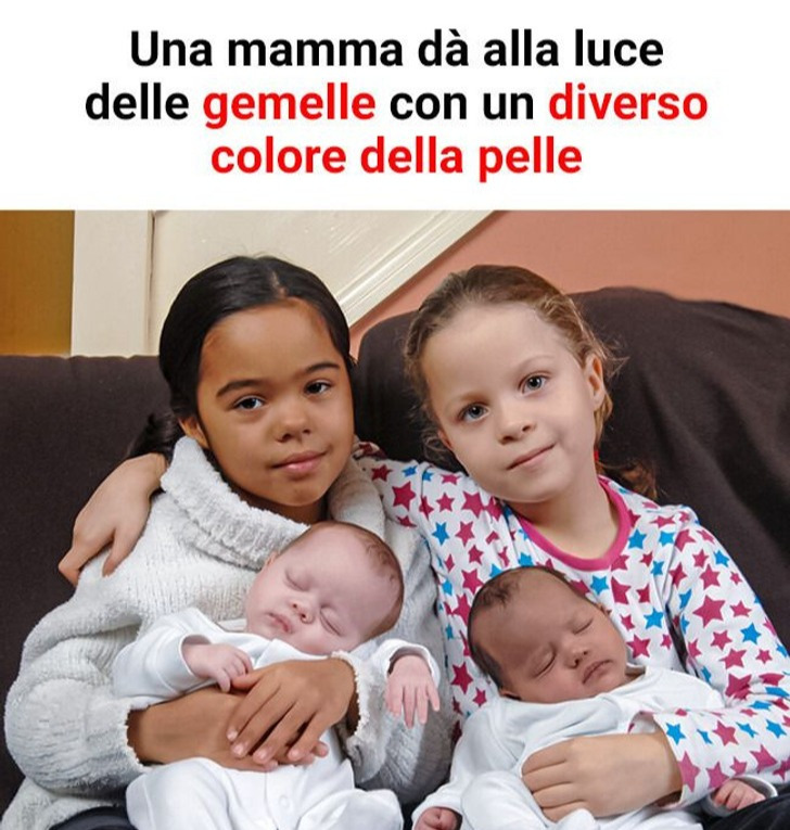 Una mamma dà alla luce delle gemelle con un diverso colore della pelle